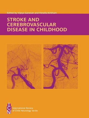 cover image of Stroke and Cerebrovascular Disease in Childhood